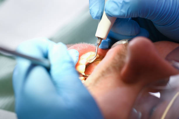 Best Walk-In Emergency Dental Services in Shelbyvle, IL